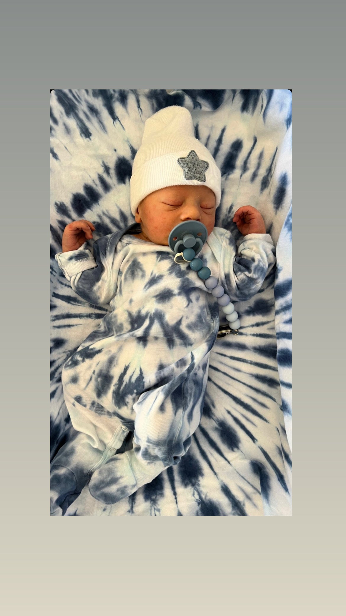 Tie Dye Take Home Set